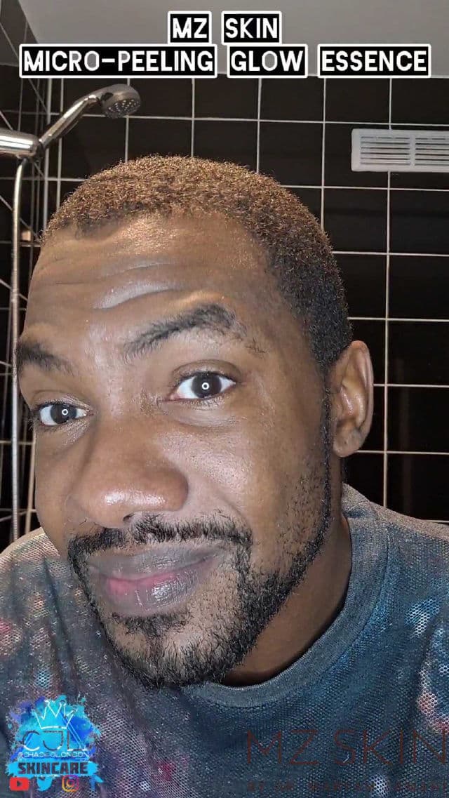 MZ Skin Micro-Peeling Glow Essence review photo by CHASEJLONDON