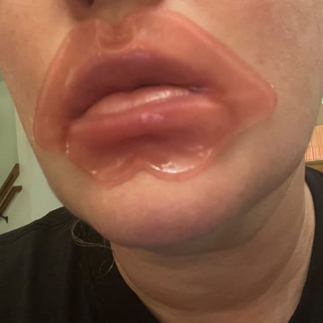 KNC Beauty All-Natural, Collagen-Infused Lip Mask review photo by MessyAssMandy