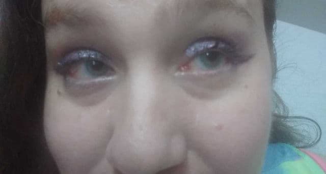 Nutrishe Nutrilash Eyelash & Eyebrow Serum review photo by inclusivereviewer