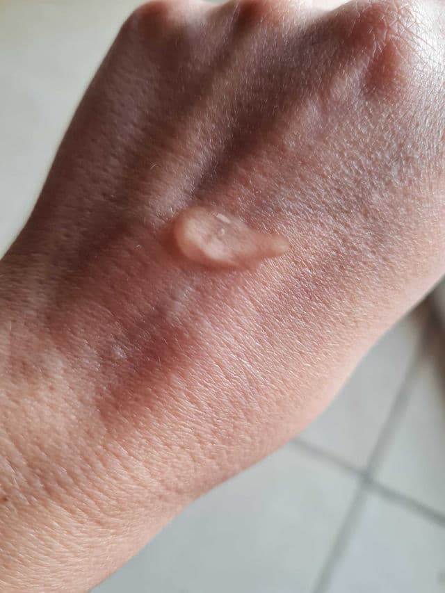 Advanced Clinicals Vitamin C Serum review photo by HanKat