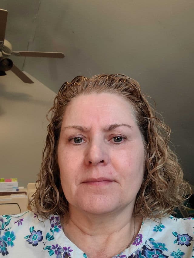 SkinLabo Intensive Lift Serum for Bags and Dark Circles review photo by Picky62157