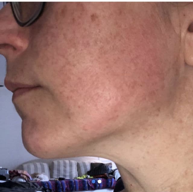 Freeman Pore Clearing French Pink Clay Peel-Off Mask review photo by moorejennie78