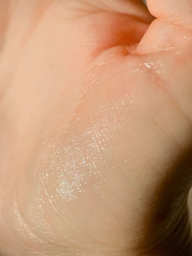 NEOGEN Surmedic Perfection 100TM All In One Facial Eye Cream review photo by MartaFra