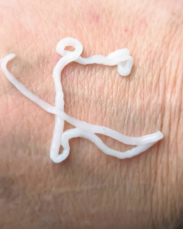 Aveeno Calm + Restore Skin Therapy Balm review photo by Mucci