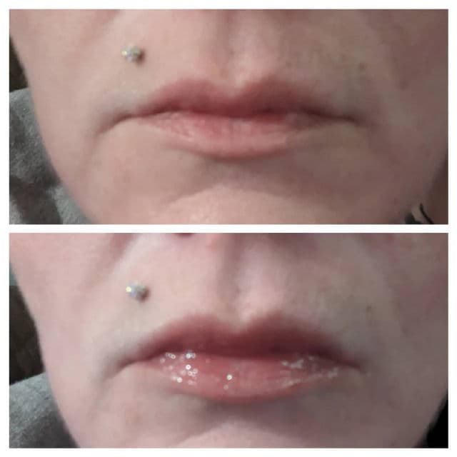 Lawless Forget The Filler Lip Plumping Line Smoothing Gloss review photo by merllamicorn