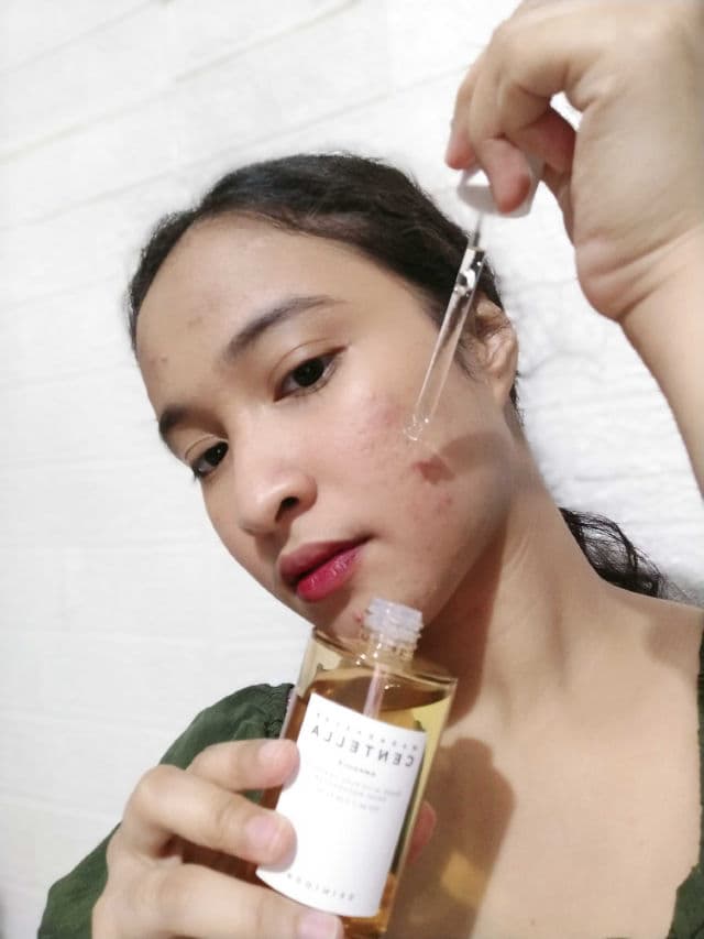 SKIN1004 Madagascar Centella Ampoule review photo by joanaaa