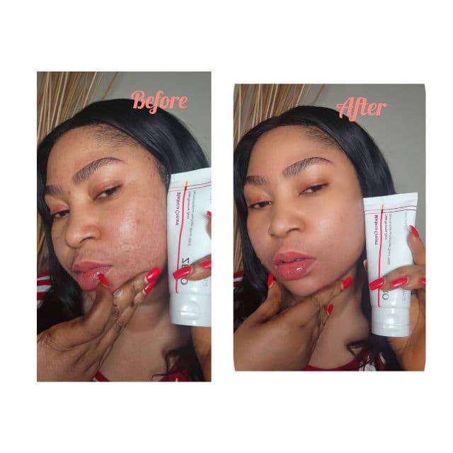 Centellian24 Madeca Cream Time Reverse Zero review photo by Cutedora27