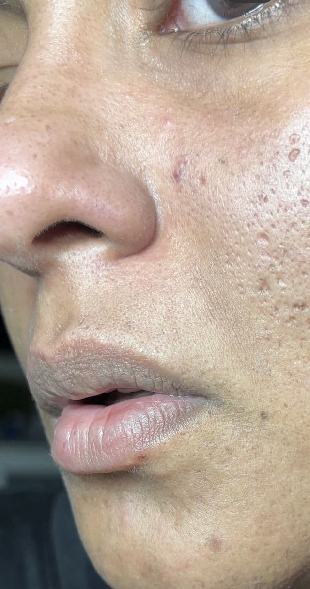 FATION Deep Barrier Soft Cleansing Foam  review photo by zoy