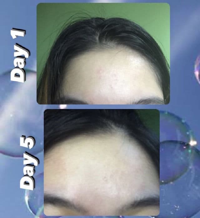 Mellow Naturals Clarifying Face Serum with Sophora Root review photo by Veraskn