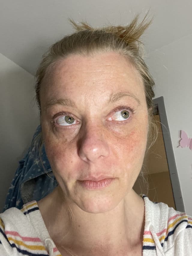 Symbiosis London Tightening & Resplendent Eye Mask review photo by Carabear