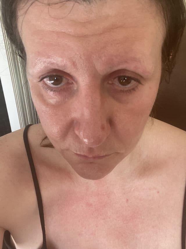 SkinLabo Intensive Lift Serum for Bags and Dark Circles review photo by picklynn