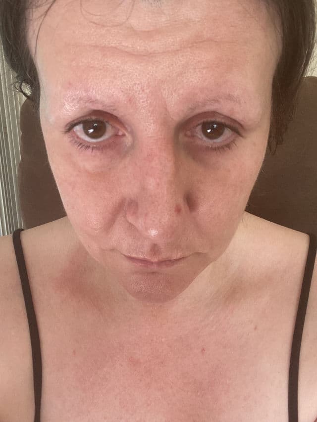 SkinLabo Intensive Lift Serum for Bags and Dark Circles review photo by picklynn