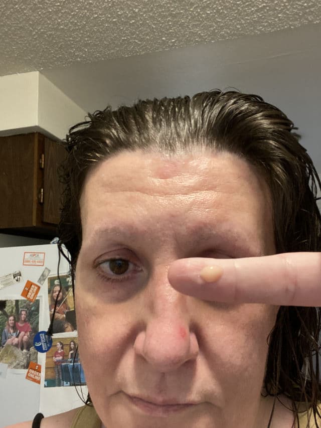 SkinLabo Intensive Lift Serum for Bags and Dark Circles review photo by picklynn