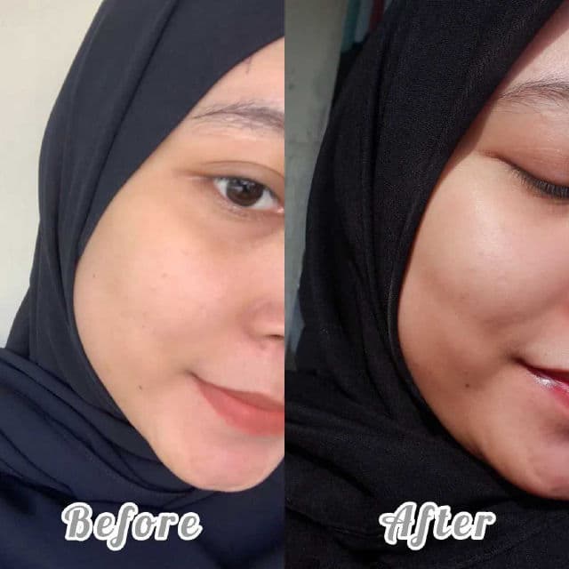 SKINBAE Advance Brightening Serum review photo by pingkywahyu