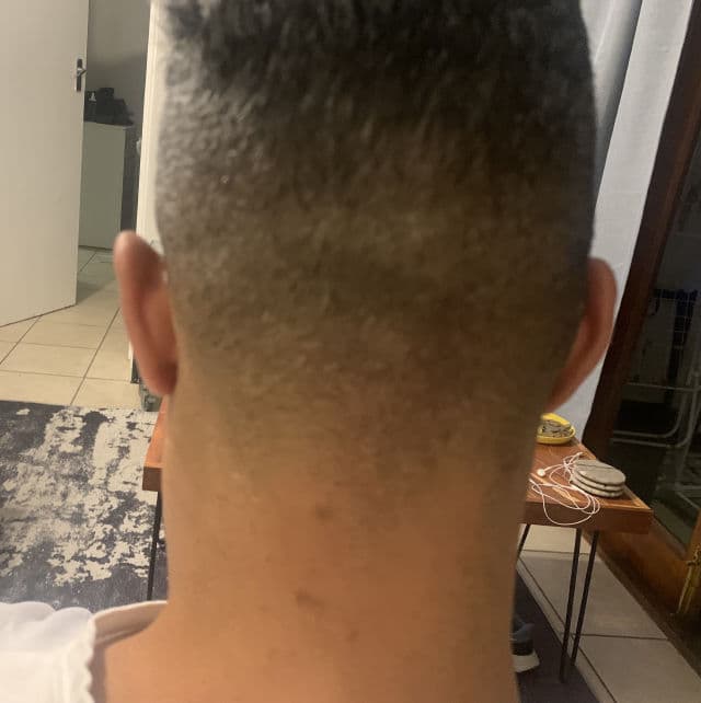 Dermalogica Clear Start Post-Breakout Fix review photo by wayne81