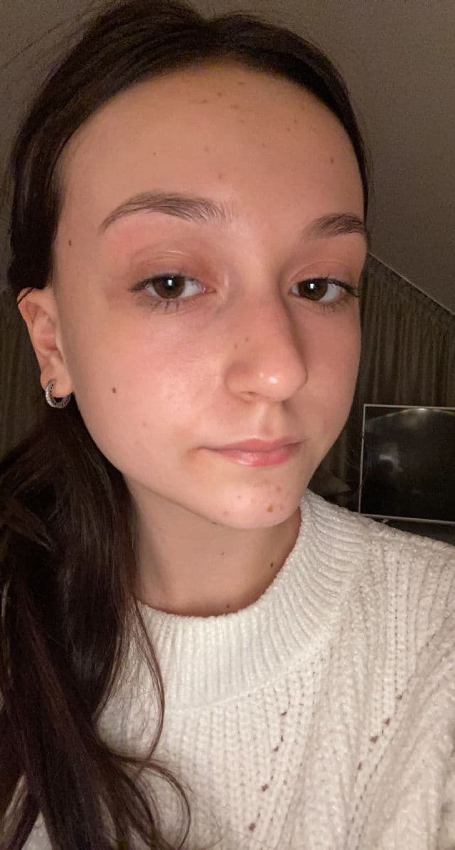 Clinique Anti-Blemish Solutions™ Clinical Clearing Gel review photo by Alexazx