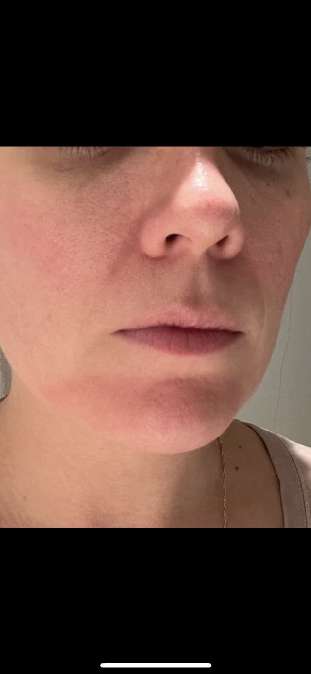 La Roche-Posay Effaclar Pore-Refining Anti-Aging Face Serum review photo by Vyn3ss