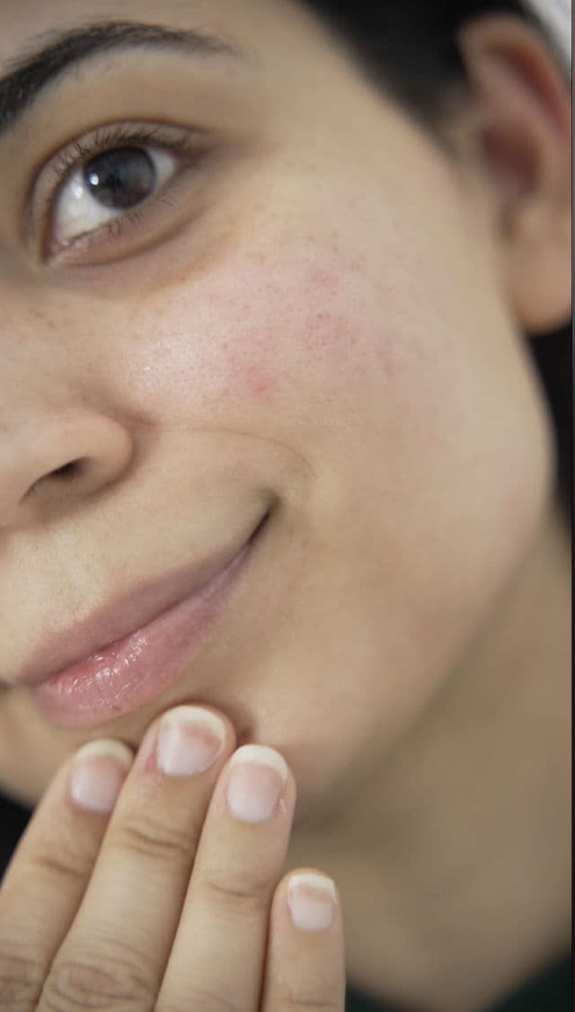 ANAIRUI Skin Care Retinol Serum	 review photo by Dhanjeet