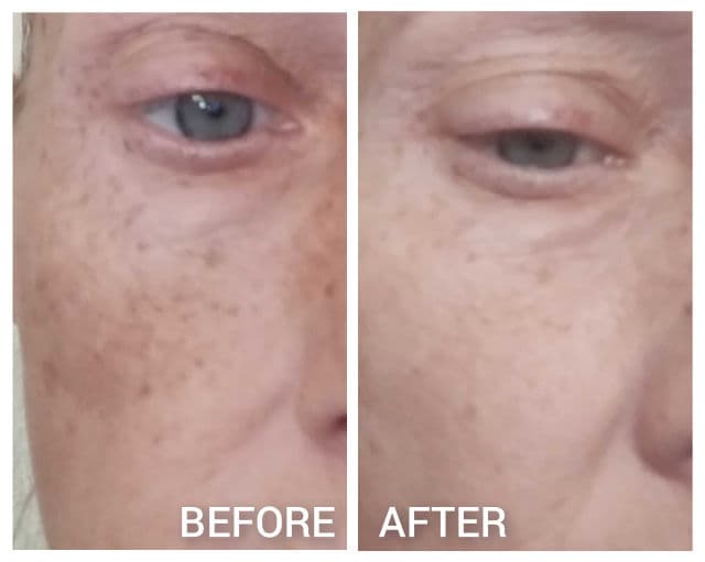 La Roche-Posay Pure Niacinamide 10 Serum review photo by vgoodwin93