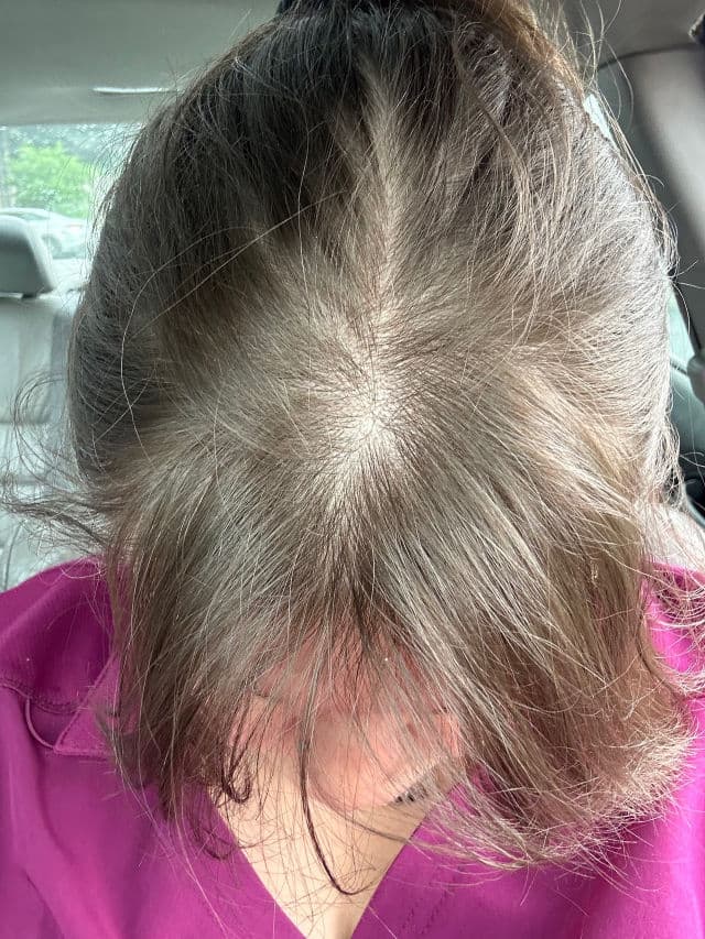 JVN Hair Pre-Wash Scalp Oil review photo by RavenA