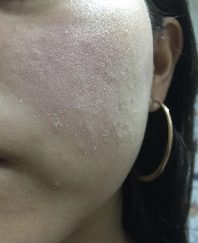 Good Molecules Hyaluronic Acid Serum review photo by cvmila