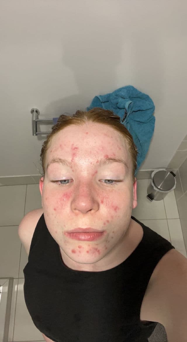 Hero Cosmetics Exfoliating Jelly Cleanser review photo by Lizzieeeee