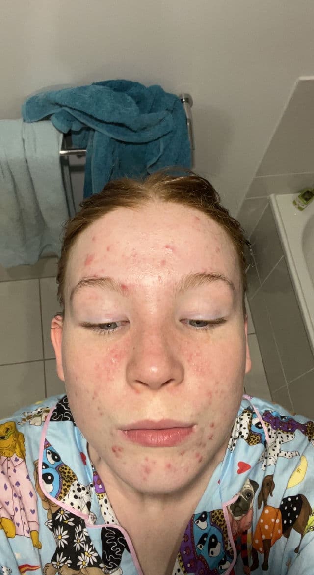 Hero Cosmetics Exfoliating Jelly Cleanser review photo by Lizzieeeee