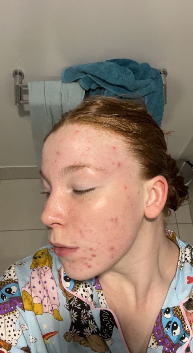 Hero Cosmetics Exfoliating Jelly Cleanser review photo by Lizzieeeee