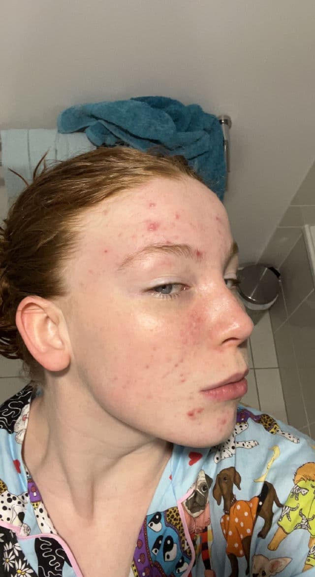 Hero Cosmetics Exfoliating Jelly Cleanser review photo by Lizzieeeee