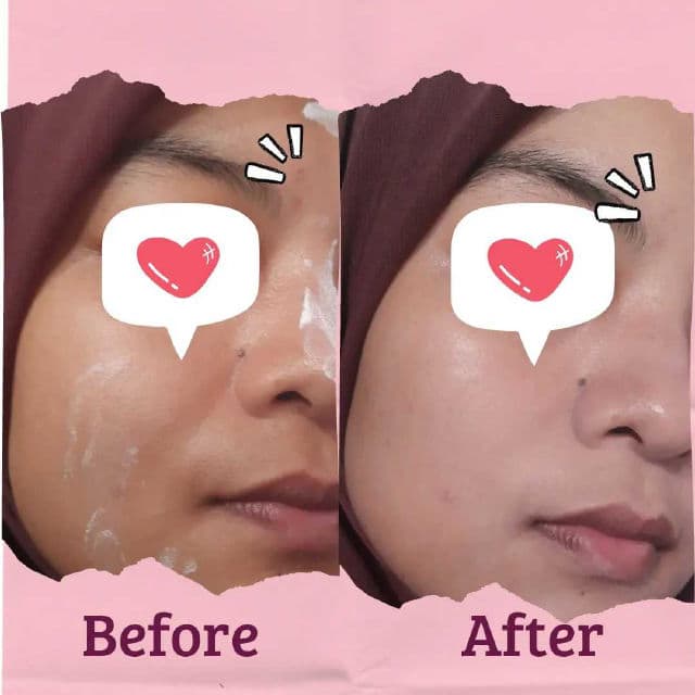 Some By Mi Rose Intensive Tone-Up Cream review photo by kikyisnaeni12