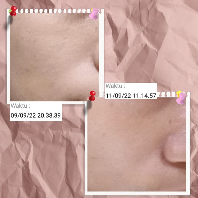 Skintific Barrier Booster Facial Oil  review photo by kikyisnaeni12