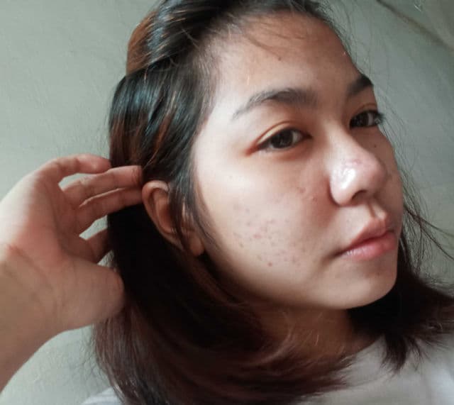 Dermorepubliq 10% Niacinamide + Hyaluronic Acid Face Anti-Blemish Serum review photo by KatrinaBandolin