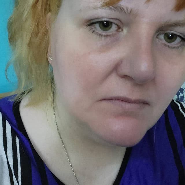 ANUA Niacinamide 10% + TXA 4% Dark Spot Correcting Serum review photo by KimfluencerNL