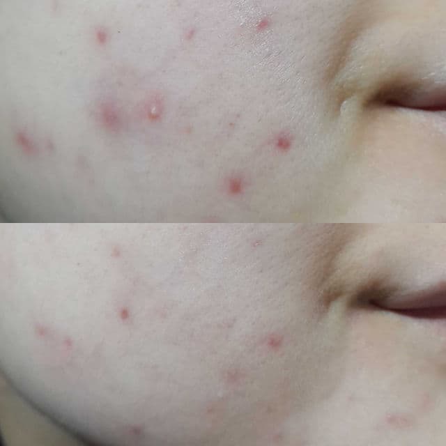 True to Skin Calaberry Brightening & Calming Serum review photo by rbbixt