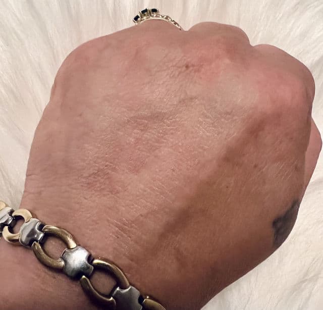 RAVIEL Multi Vitamin Dark Spot & Blemish Care Face Serum review photo by mrsdmk1969