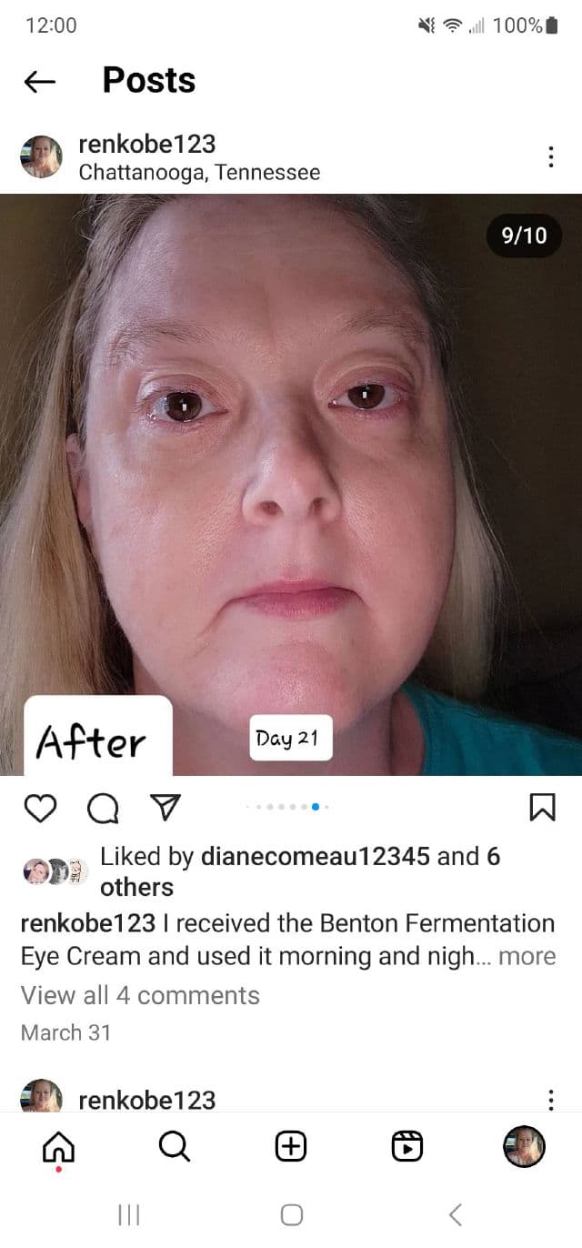 Fermentation Eye Cream product review