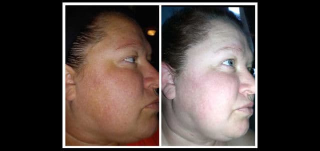 Vitabrid C12 Dual Drop Serum review photo by DiscoveringDaily