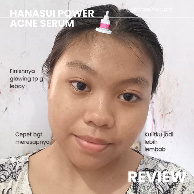 Hanasui Cosmetics Power Acne Serum review photo by llaviraa