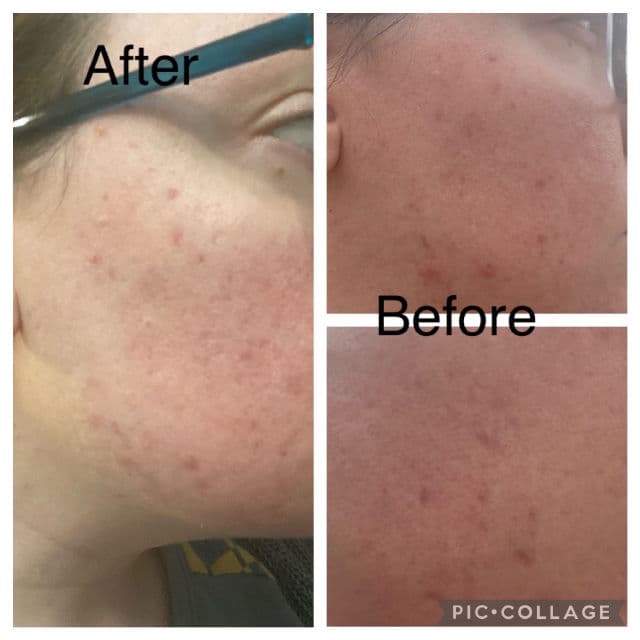 Rael Lighten Up - Cica Spot Corrector review photo by jennstarwalt