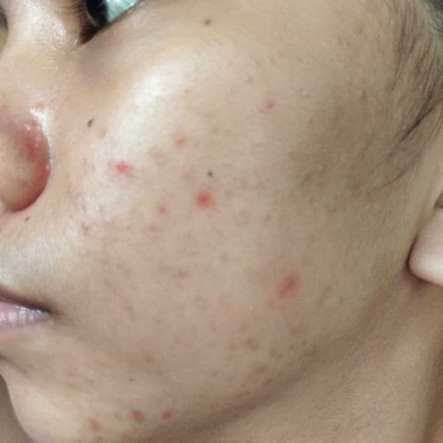 Celeteque Hydration Facial Moisturizer review photo by bunnybun