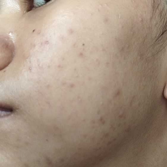 SKIN1004 Madagascar Centella Ampoule review photo by bunnybun