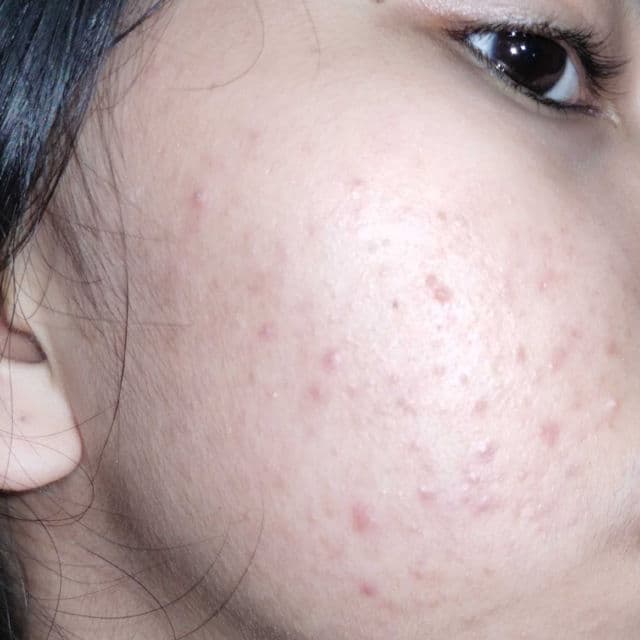 Derma Natufian AHA BHA PHA Leaf Wash Miracle Perfect Toner review photo by bunnybun