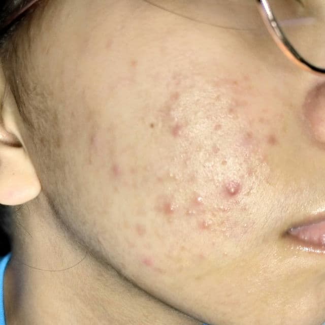 Derma Natufian AHA BHA PHA Leaf Wash Miracle Perfect Toner review photo by bunnybun