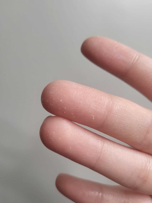 Neutrogena Ultra Sheer Liquid Daily Sunscreen Broad Spectrum SPF 70 review photo by Marilynn