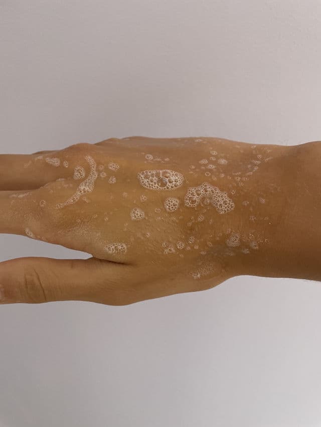 The Inkey List Salicylic Acid Cleanser review photo by koreanskicarelover