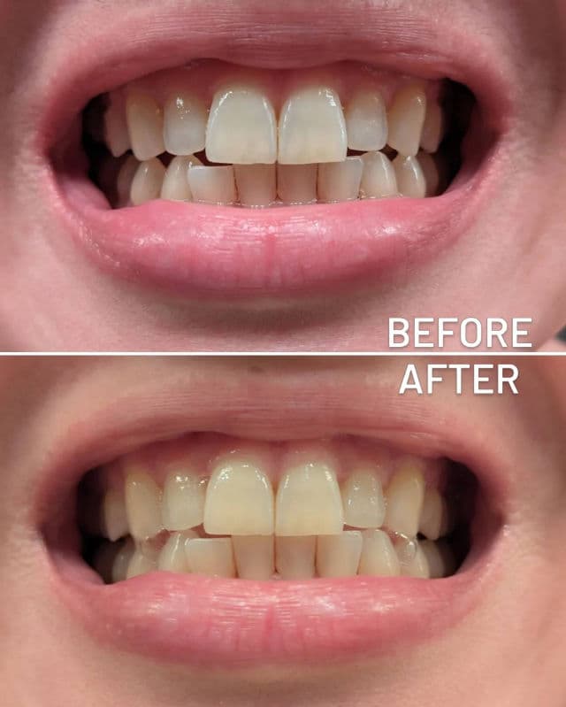 HIMALAYA PINK SALT Intensive Whitening Toothpaste review photo by skinlovenotes