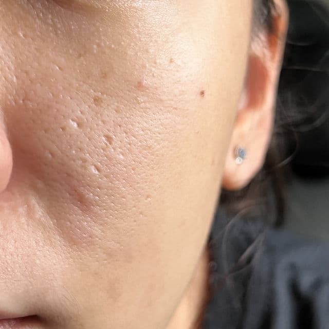 Paula's Choice Skin Balancing Pore-Reducing Toner review photo by Skincarewithtofu