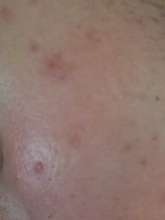 Garnier 3.5% Vitamin C, Niacinamide, Salicylic Acid, Brightening & Anti Dark Spot Serum review photo by Aidenpkb