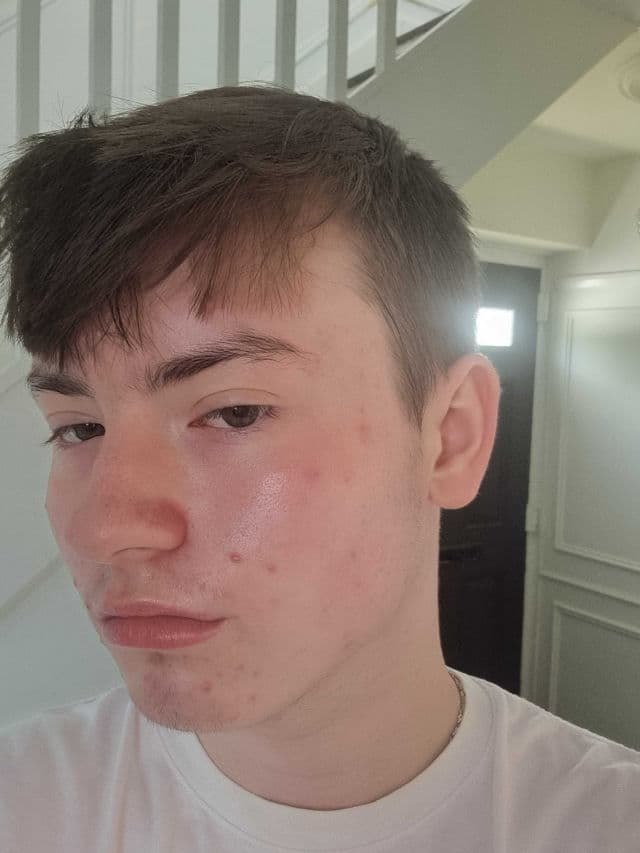 Garnier 3.5% Vitamin C, Niacinamide, Salicylic Acid, Brightening & Anti Dark Spot Serum review photo by Aidenpkb