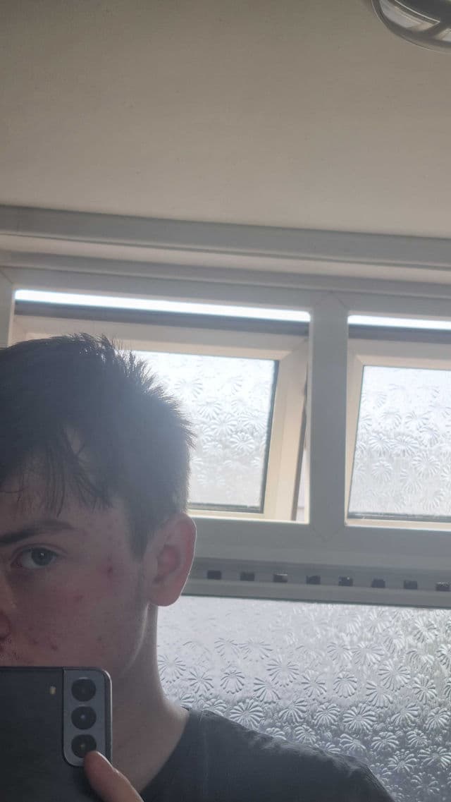 Garnier 3.5% Vitamin C, Niacinamide, Salicylic Acid, Brightening & Anti Dark Spot Serum review photo by Aidenpkb